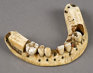 teeth 18th century